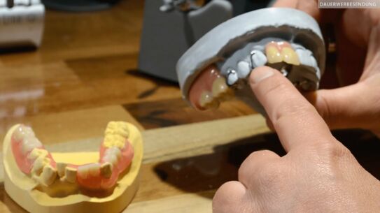 Zahnprothesen mit Kunststofftechnik